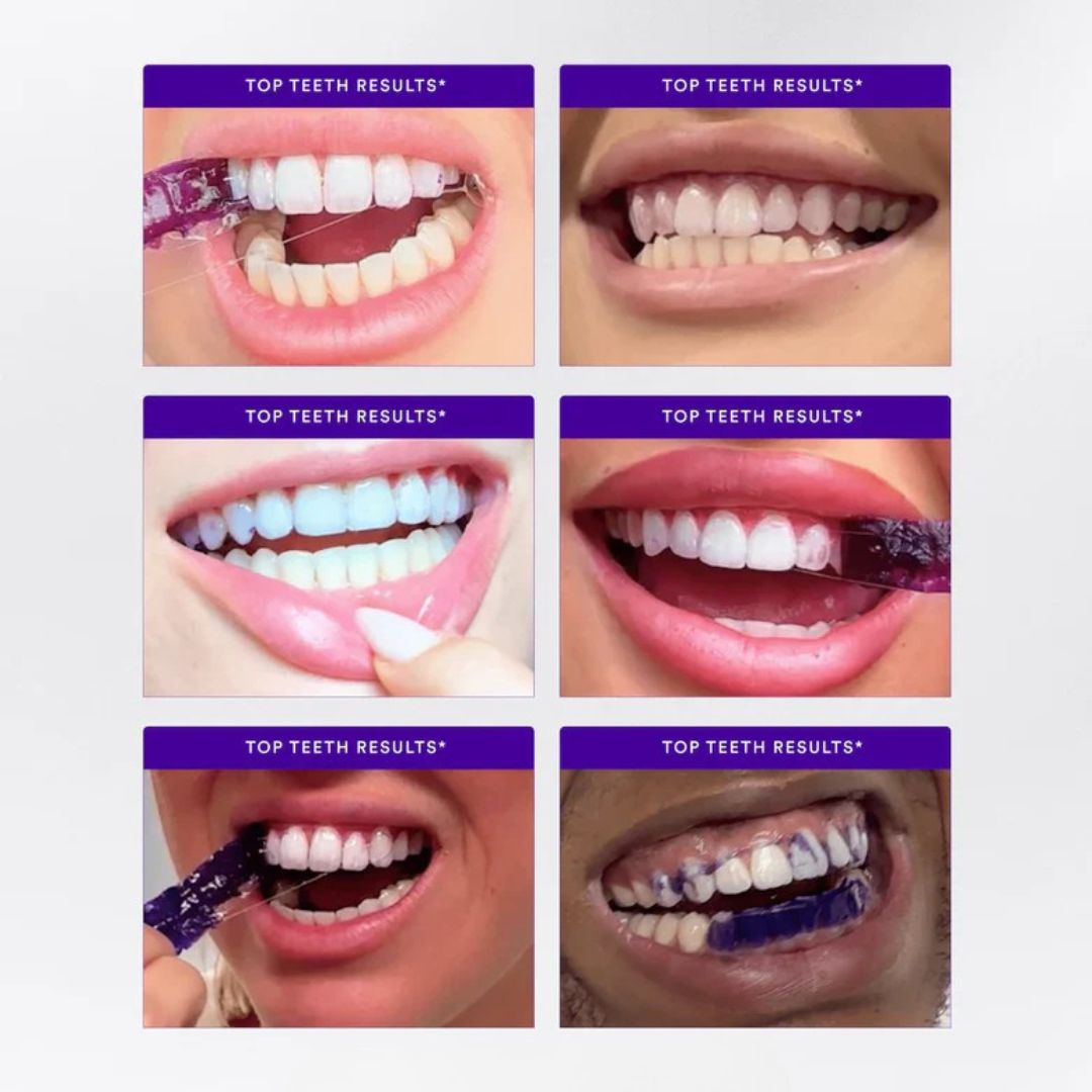 V34 Teeth Whitening Strips (PAP+ Formula)